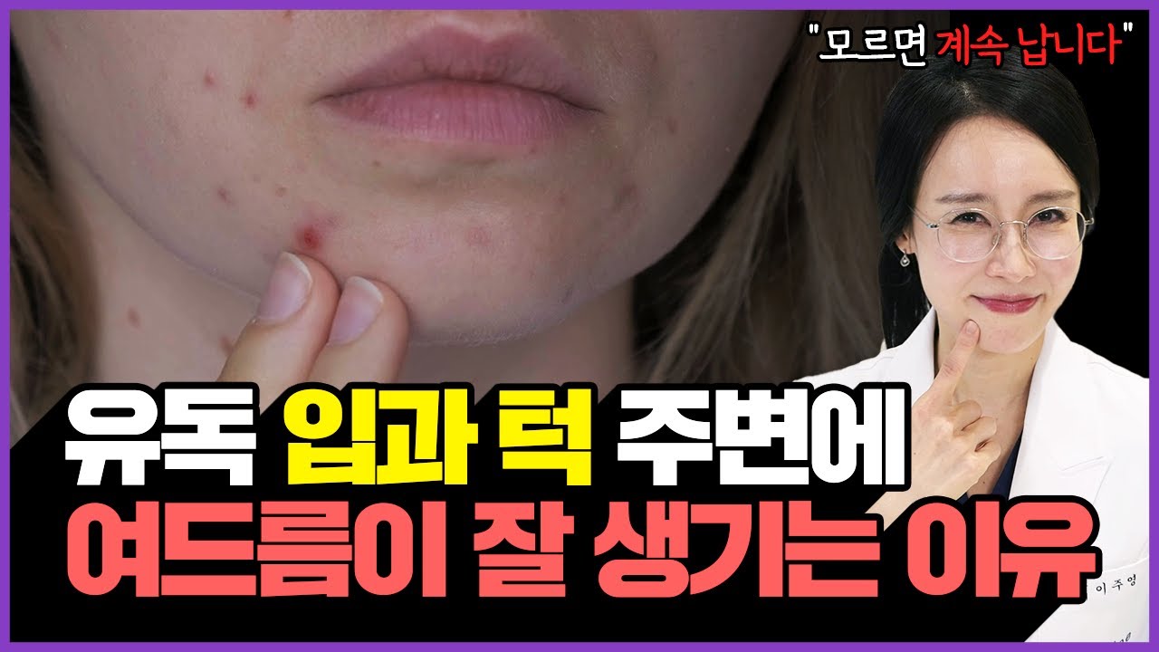 이거 모르면 계속 여드름이 날 수밖에 없습니다ㅣ19년차 의사가 알려주는 입과 턱 주변 성인 여드름