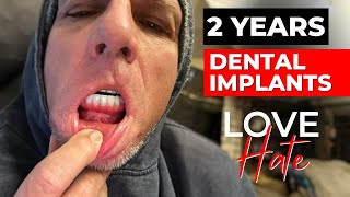 My BIGGEST Worries When I Got Dental Implants