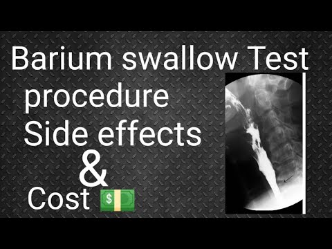 Barium Swallow Taste /Technique, Procedure, Indications,  Side-effects,  Cost in Urdu and hindi