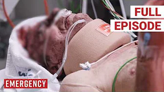 Doctor's Heartbreaking Tumor Discovery On Car Crash Victim | S4 Ep 9 | Emergency