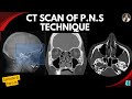 CT Scan of PNS Technique-Lecture:21 (Part-01)| Tutorial-41| PNS Anatomy | CT Scan PNS Filming |