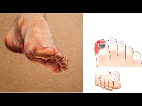 أصابع القدم تفسير الأحلام أكثر من خمسة أصابع قطع اصبع القدم