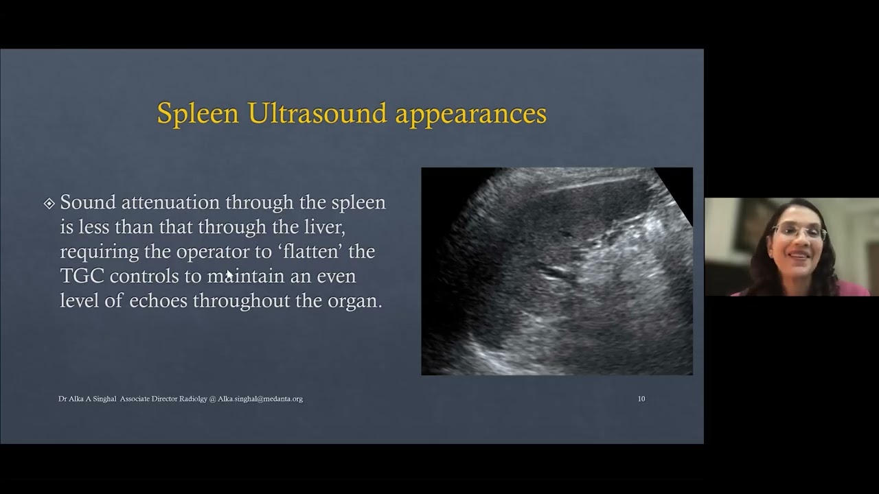 Thumbnail for Ultrasound Spleen with Dr. Alka Singhal | Medality / MRI Online Radiology Course
