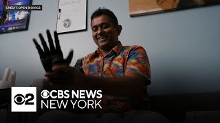 Bronx man is 1st person to get 3D-printed bionic arm
