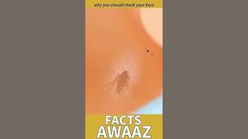 why you should check your ears for bugs #shorts #short #shortsvideo