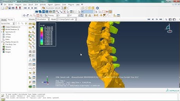 simulation  lumbar spine in Abaqus