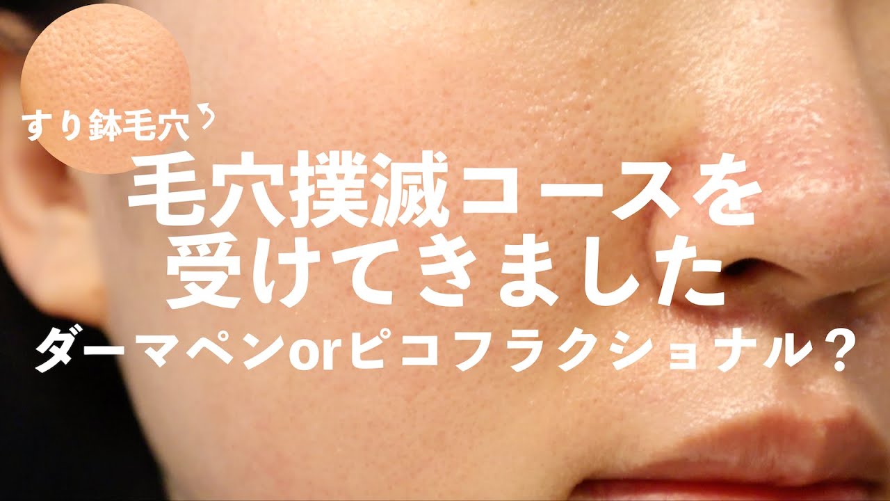 敏感肌さん必見 毛穴黒ずみ対策方法的youtube视频效果分析报告 Noxinfluencer