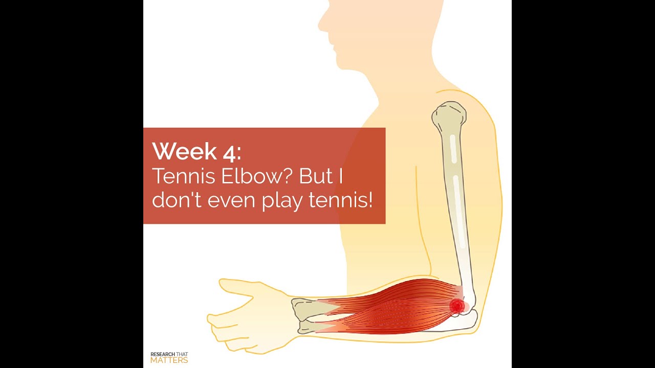 Tennis Elbow? But I Don’t Even Play Tennis!