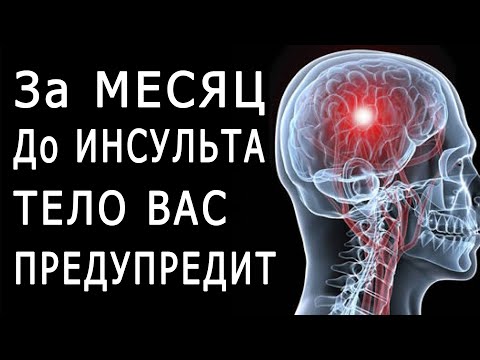 Перед Инсультом Ваше Тело Предупредит Вас - Симптомы Инсульта, которые НЕЛЬЗЯ Игнорировать