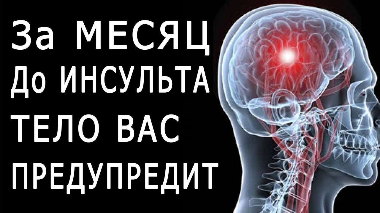 Полу инсульт. Инсульт. Организм предупреждает об инсульте. Признаки инсульта. Первые признаки инсульта.