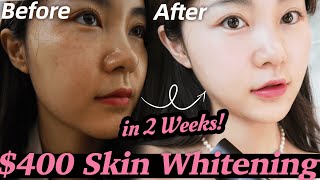 REAL EXPERIENCE: k-pop idols whitening treatment Unexpected results ? | Lyn Beauty