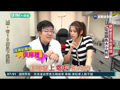 胎記如何產生? 依"顏色"區分種類!｜健康大群組｜華視新聞 20211203