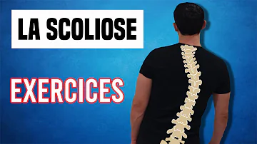 Comment muscler dos scoliose ?