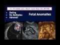 AIUM Webinar: Systematic Evaluation of the 11-14 Week Fetus, Touching on ISUOG Guidelines