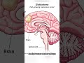 Yüksek Dereceli Glial Kitle: Glioblastoma Güncel Yaklaşım.