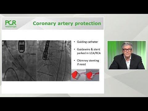 TAVI and coronary