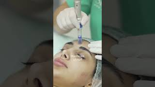 Get Mesotherapy for Glowing, Healthy Skin