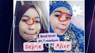 Real Testimoni Cream RK Glow Kosmetik Viral