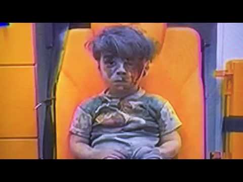 Omar Daqneesh Five Year Old Syrian Boy Homeless Due To Syria War