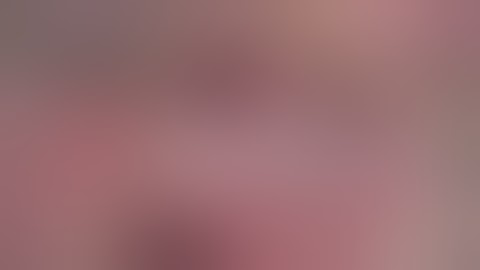 Anatomy, Utero-sacral Ligament Neurectomy (Frankenhauser), 36s