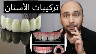 تركيبات الاسنان الثابتة | أفضل طريقة لعمل تركيبات الاسنان خصوصا التجميل في الاسنان الامامية