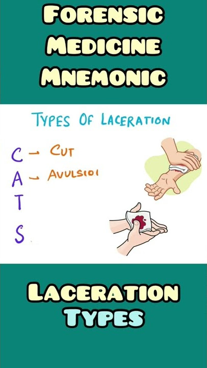 Laceration : Types - mnemonic  | Forensic Medicine , Surgery | #shorts