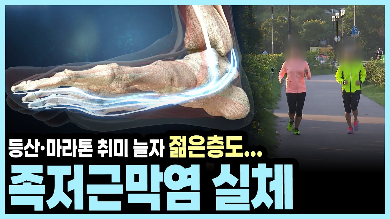 "키높이 깔창·플랫슈즈가 원인?" 발바닥 아치 무너뜨리는 신발 습관과 예방법 I KBS 알약톡톡 20160430 방송