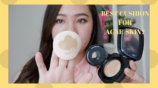 best cushion for acne skin