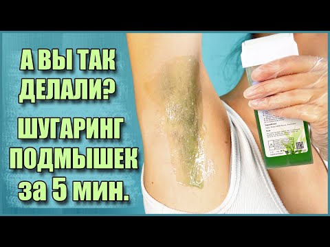 А вы так делали? Шугаринг подмышек картриджем за 5 минут!