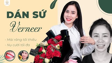Kiến Tạo Nụ Cười Chuẩn Đẹp Nhờ Dán Sứ Verneer | Bác sĩ Trung Long Biên