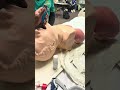 Unsuccessful Intubation Attempt: Identifying Improper ETT Placement and No Chest Rise