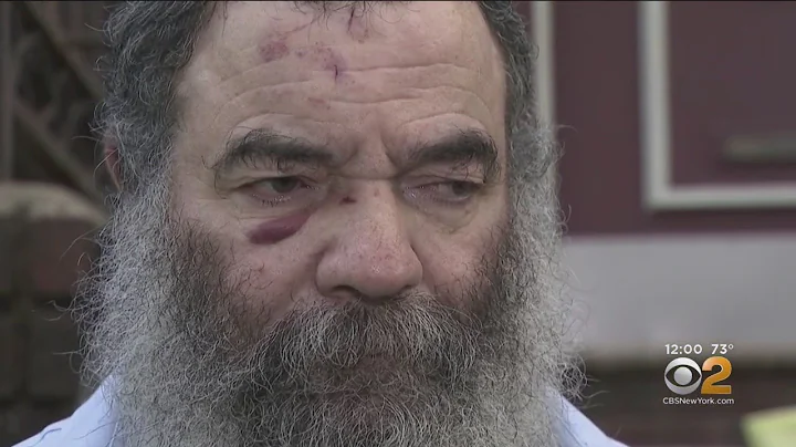 Exclusive: Park Attack Victim Speaking Out About Possible Hate Crime