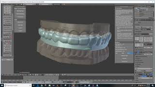 Updates to the Curves and Wax Rim Control D3Splint v0.7.0