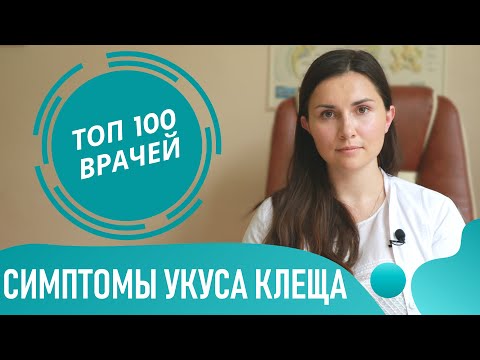 УКУС КЛЕЩА: симптомы и признаки у человека. Как выглядит место укуса клеща (фото 1-7)