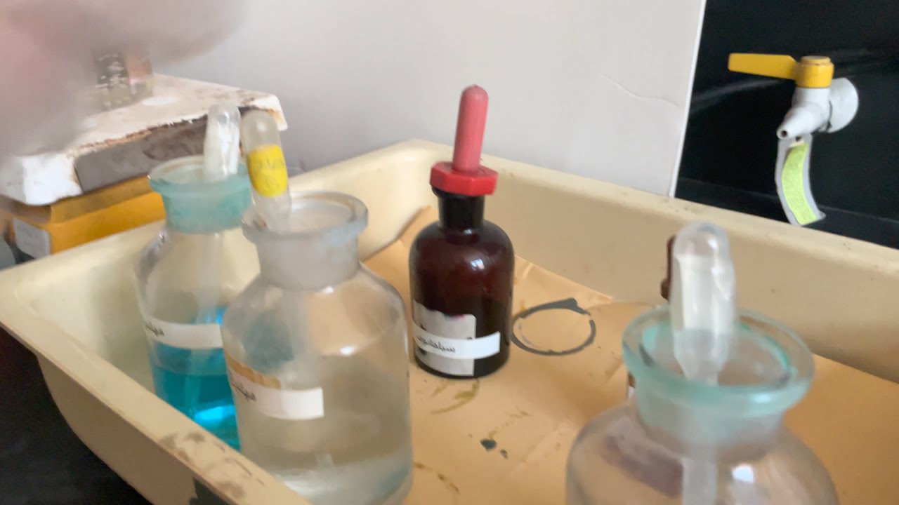 الكشف عن سكر الجلوكوز