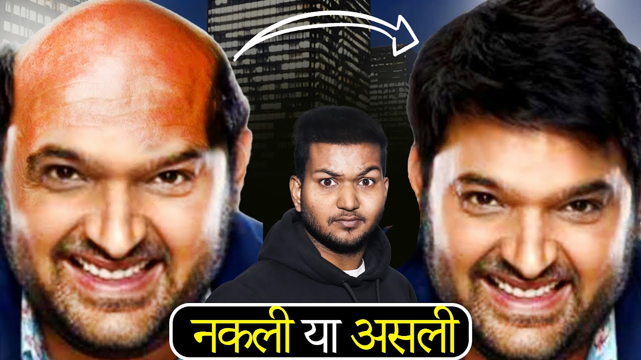 Kapil Sharma के बालों की सच्चाई! Real vs Fake?