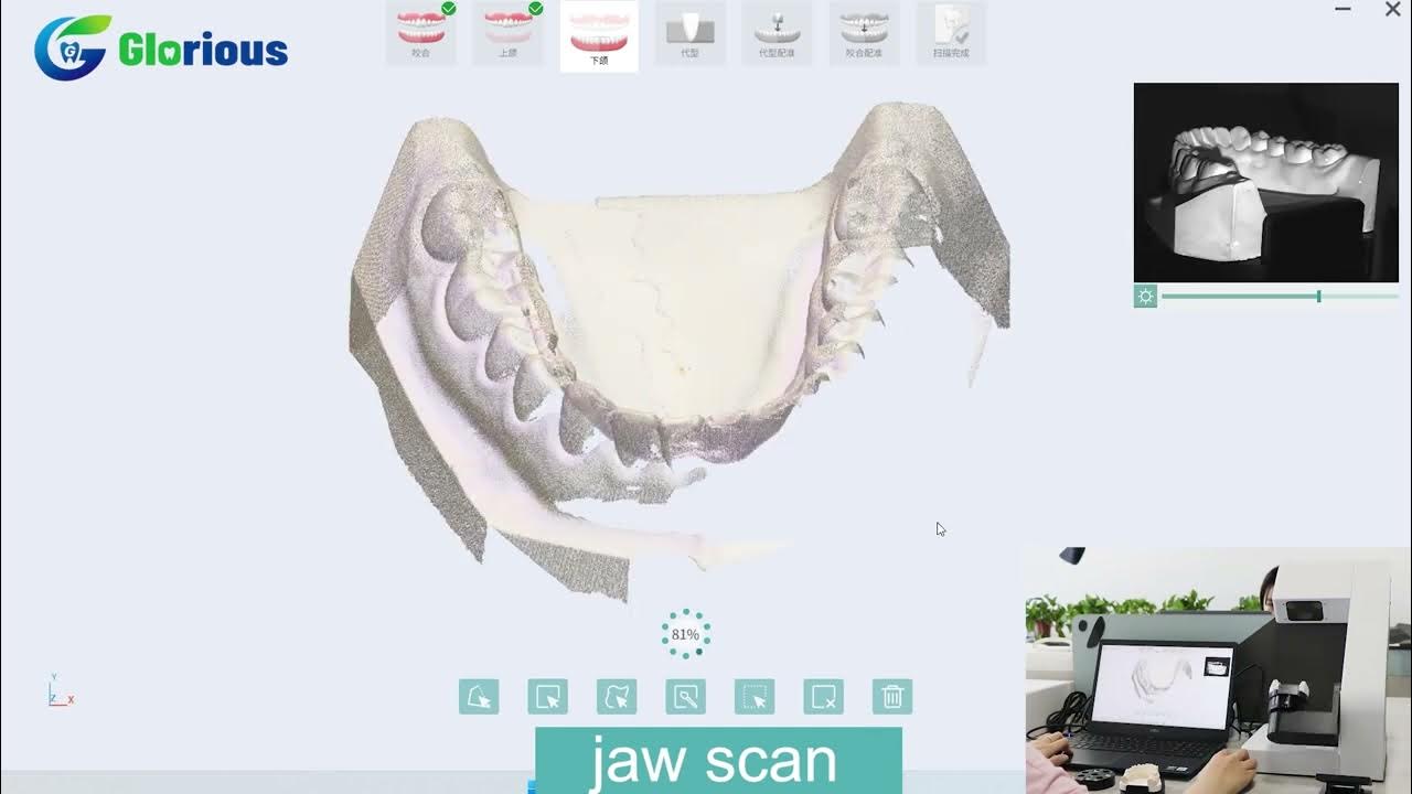 Glorious Dental 3D Scanner Jaw Scan Video YouTube