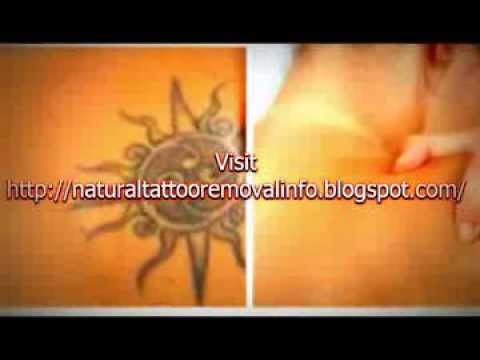 ... Remove a Tattoo at Home - Before and After Natural Tattoo Removal