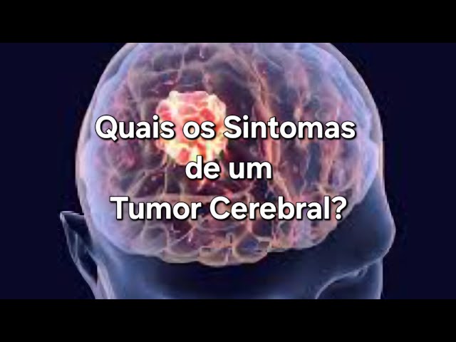 Quais os Sintomas de um Tumor Cerebral?