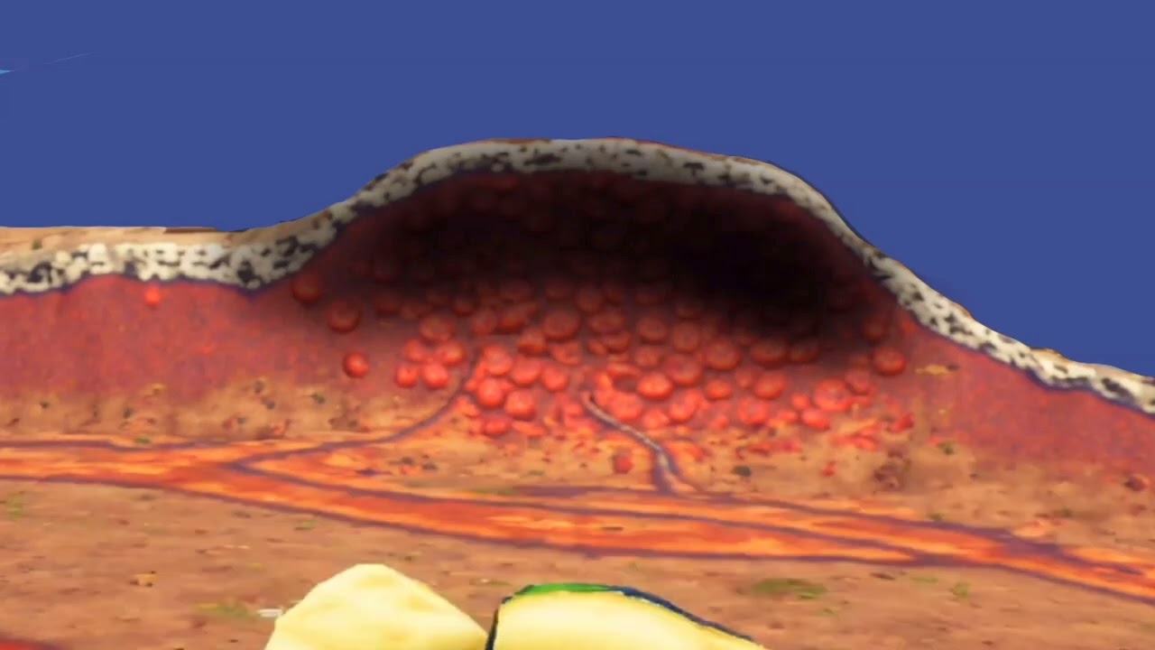 Warts EXPLAINED in 3D Animation!