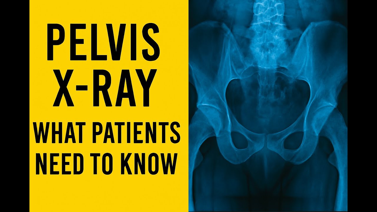 Pelvic X-Ray Explained | Preparation, Purpose & Diagnosis