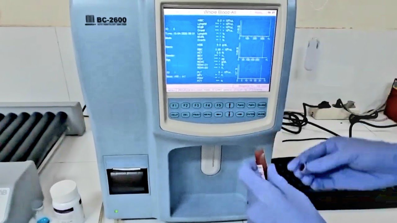 HEMATOLOGI ANALYZER