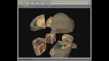 Silicon Graphics. Volume Rendering Demo: T-Vox 1.0 from Hotmix CD #16