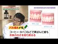 エミデントは歯ブラシの究極形態！？磨かずに歯にあてるだけ！！最新技術を搭載した100％超音波歯ブラシの登場にドランクドラゴンの2人も大興奮！！【公式】