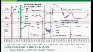 An extracerebral biosignal pattern for epileptic seizure detection