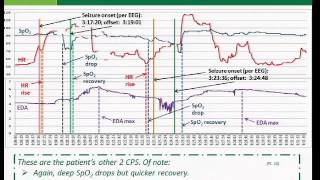 An Extracerebral Biosignal Pattern For Epileptic Seizure Detection