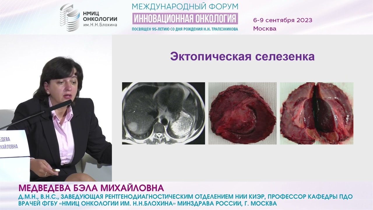Ранний рак печени: что это такое и как его выявить?_Кудашкин Н.Е.