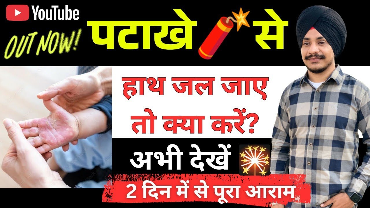 🧨पटाखे से जले हुए हाथ को कैसे ठीक करें | जला हुआ घाव ठीक करने की दवा | Burn Skin Treatment In Hindi