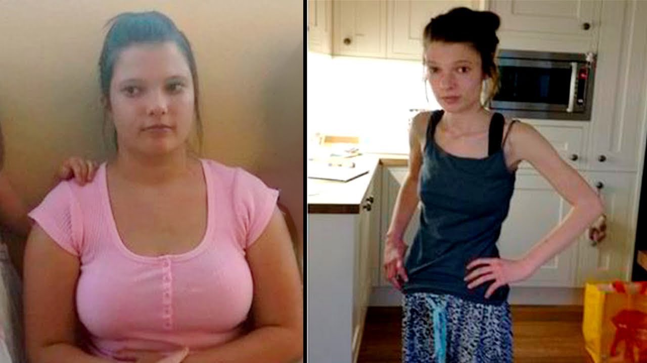 9 случаев, когда диета пошла ужасно не так!