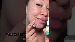 How do pimple patches work? #skincare #pimplepatch #acne